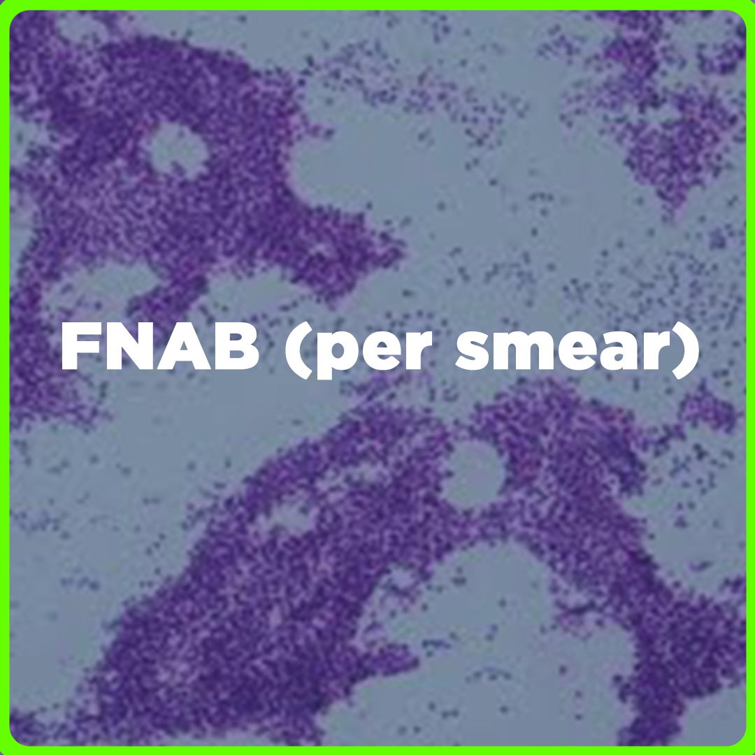 FNAB (per Smear) price in the Philippines | MedsGo Pharmacy