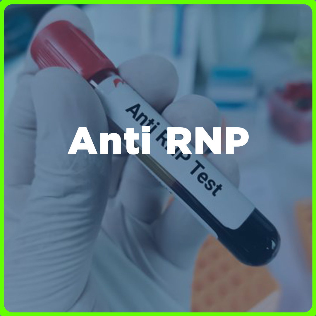 Anti RNP price in the Philippines | MedsGo Pharmacy