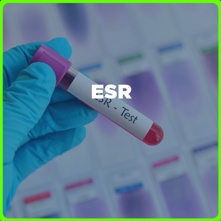 ESR price in the Philippines | MedsGo Pharmacy